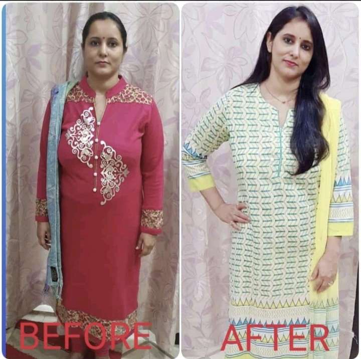 Dr. Nidhi before and after transformation result